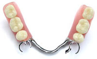 partialdentures