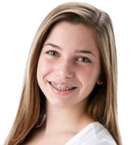 teenbraces